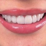 photo 2 2025 01 06 16 33 50 small